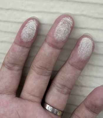 チョーキング（白い粉が付く）